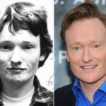 Conan O'Brien before and after plastic surgery (17)