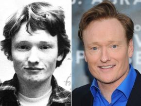 Conan O'Brien before and after plastic surgery (17)