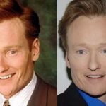 Conan O'Brien before and after plastic surgery (2)