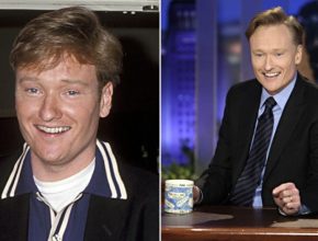 Conan O'Brien before and after plastic surgery