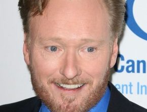 Conan O'Brien plastic surgery (24)