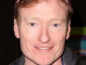 Conan O'Brien plastic surgery (4)