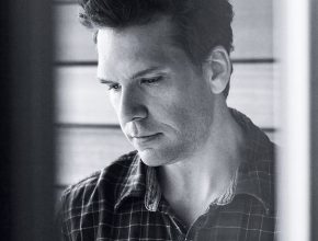 Dane Cook plastic surgery (38)