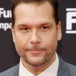 Dane Cook plastic surgery (39)