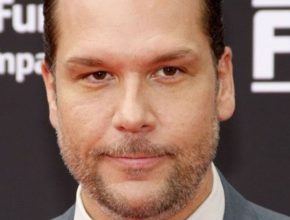 Dane Cook plastic surgery (39)