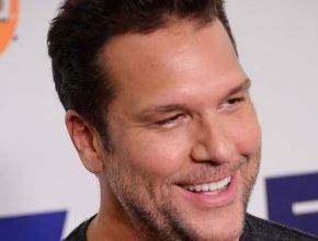 Dane Cook plastic surgery (42)