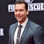 Dane Cook plastic surgery (43)