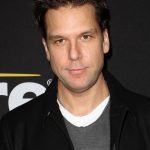 Dane Cook plastic surgery (46)