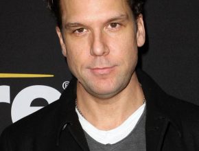 Dane Cook plastic surgery (46)