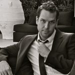 Dane Cook plastic surgery (47)