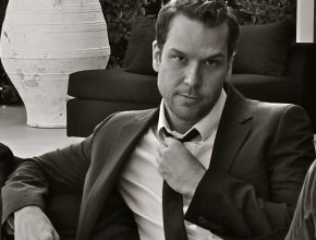 Dane Cook plastic surgery (47)