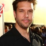 Dane Cook plastic surgery (49)