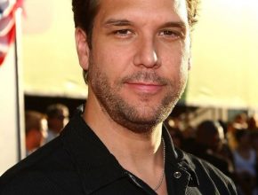 Dane Cook plastic surgery (49)