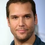 Dane Cook plastic surgery (52)