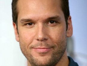 Dane Cook plastic surgery (52)