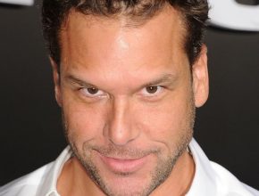 Dane Cook plastic surgery