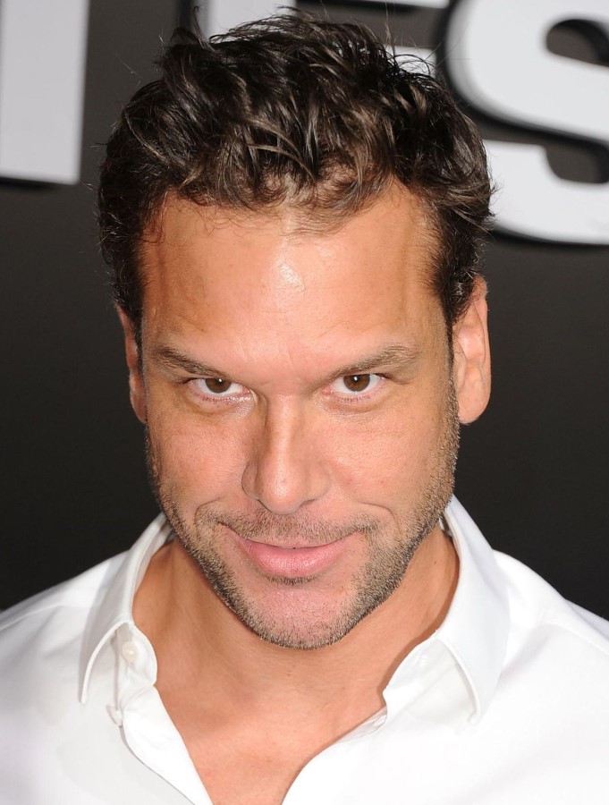 Dane Cook plastic surgery