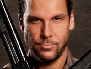 Dane Cook plastic surgery (55)