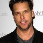 Dane Cook plastic surgery (56)