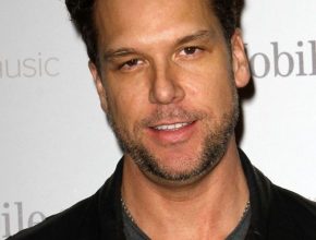 Dane Cook plastic surgery (56)