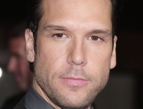 Dane Cook plastic surgery (62)