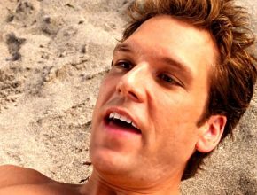 Dane Cook plastic surgery (63)