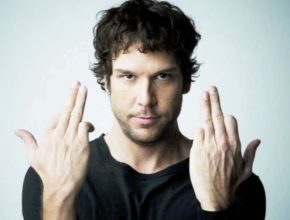 Dane Cook plastic surgery (68)