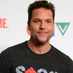 Dane Cook plastic surgery (69)