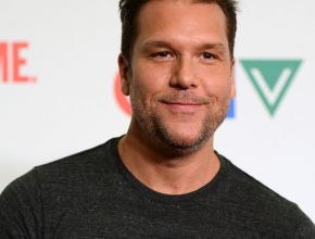 Dane Cook plastic surgery (69)