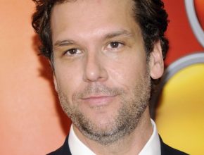 Dane Cook plastic surgery (70)