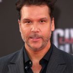 Dane Cook plastic surgery (71)