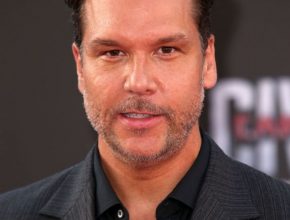 Dane Cook plastic surgery (71)