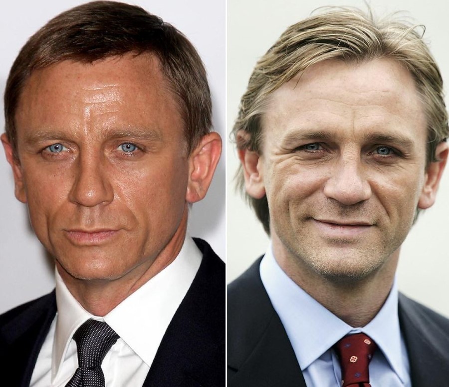 Daniel Craig before and after plastic surgery