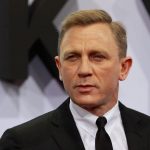 Daniel Craig plastic surgery (1)