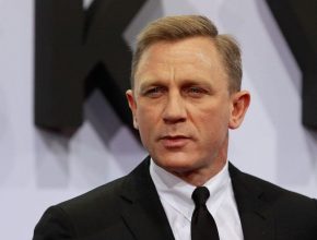 Daniel Craig plastic surgery (1)