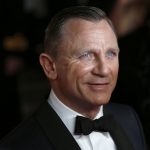 Daniel Craig plastic surgery (10)