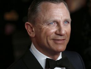 Daniel Craig plastic surgery (10)