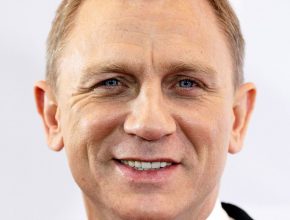 Daniel Craig plastic surgery (13)