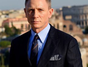 Daniel Craig plastic surgery (14)