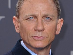 Daniel Craig plastic surgery (15)