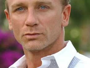 Daniel Craig plastic surgery (17)