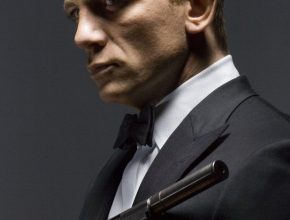 Daniel Craig plastic surgery (18)