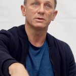 Daniel Craig plastic surgery (19)