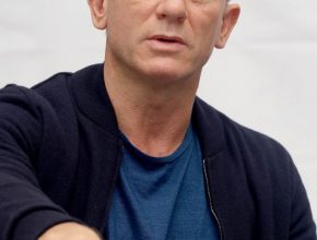 Daniel Craig plastic surgery (19)