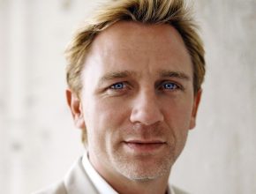 Daniel Craig plastic surgery (20)