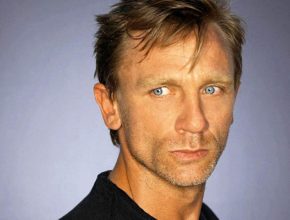 Daniel Craig plastic surgery (22)