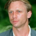 Daniel Craig plastic surgery (24)