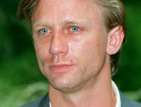 Daniel Craig plastic surgery (24)