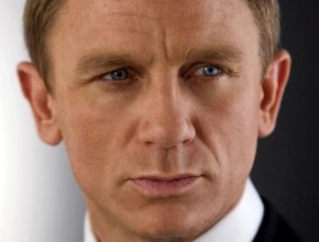 Daniel Craig plastic surgery (25)