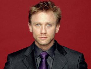 Daniel Craig plastic surgery (26)